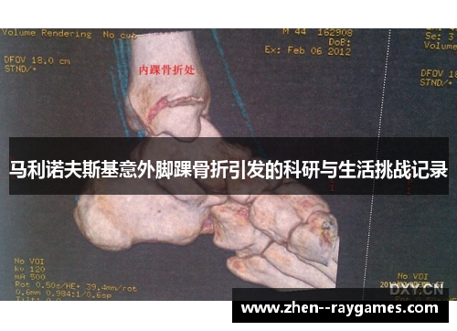 马利诺夫斯基意外脚踝骨折引发的科研与生活挑战记录
